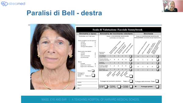 Facial Nerve Palsy: Evaluation and Treatment (Dr. Mara Robinson) - Streamed Stand C14