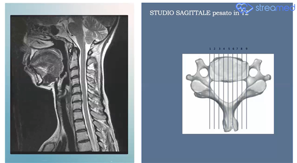 Diagnostic Imaging in Rehabilitation: Cervical and Dorsal Spine (Prof. Mauro Branchini) - Streamed Stand C14